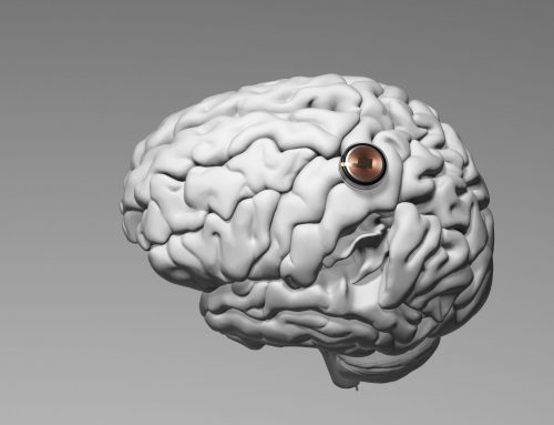 Musks Start-up Neuralink erhält grünes Licht für Gehirn-Computerchip-Tests an Menschen